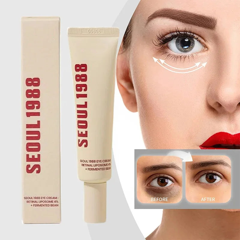 Seoul 1988 Eye Cream – Korean Anti-Aging & Dark Circle Solution